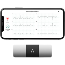 KardiaMobile 6-Lead Personal EKG Monitor &ndash; Six Views of The Heart &ndash; Detects AFib and Irregular Arrhythmias &ndash; Instant Results in 30 seconds &ndash; Works with Most Smartphones - FSAHSA Eligible