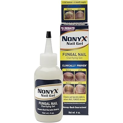 Nonyx Nail Gel, 4.0 OZ 2 Pack